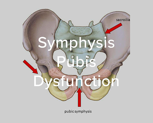 Pubic Symphysis Dysfunction Jk Physio And Rehab Clinics 8736